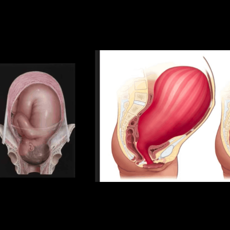 uterus for birth